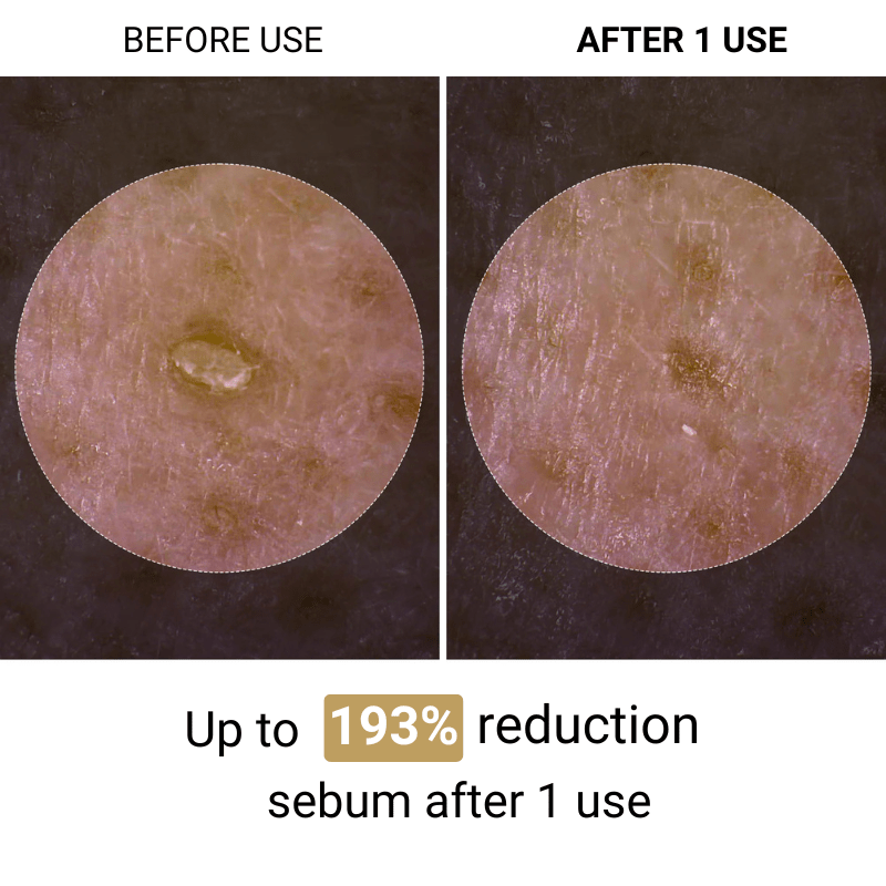 Lumora™ | Korean Peeling Ampoule