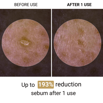 Lumora™ | Korean Peeling Ampoule